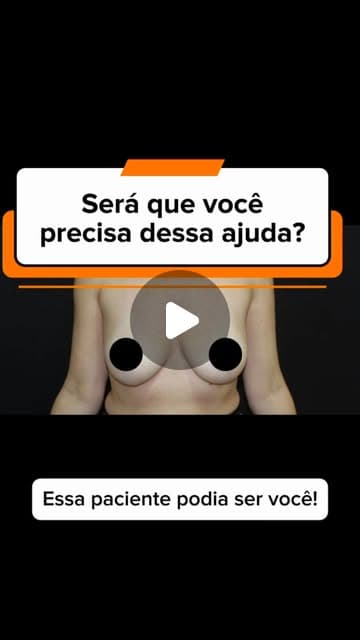 Capa do Reel: fotografia clínica das mamas, com o título “Será que você precisa dessa ajuda?”